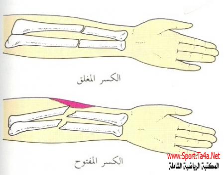 بور بوينت عن الكسور