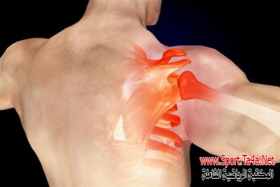 إصابات مفصل الكتف - بحث